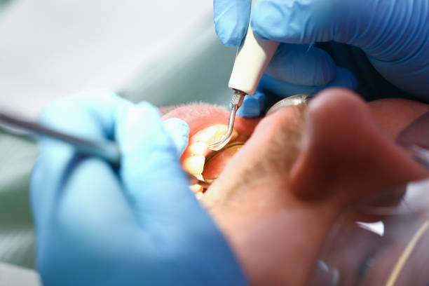 Best Emergency Dental Care for Trauma or Injury in Mascotte, FL