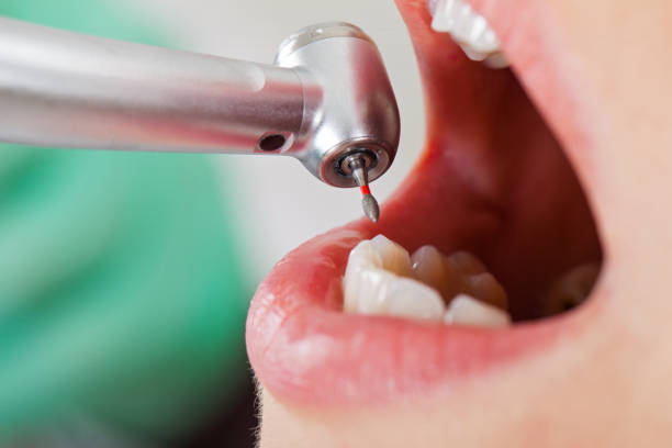 Best Weekend Emergency Dentist in Mascotte, FL